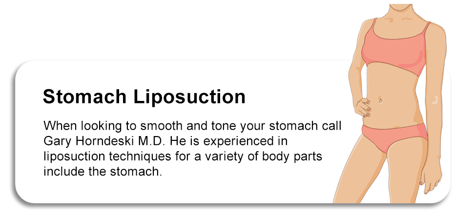 Breast Explant Surgery