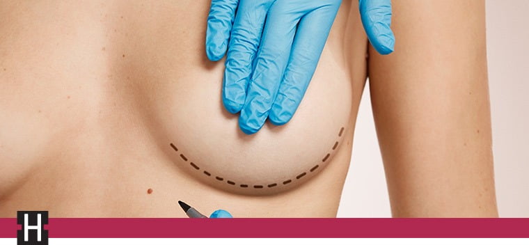 Plastic Surgeon